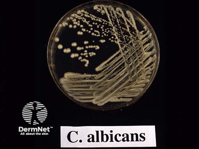 Candida albicans: microscopy and culture