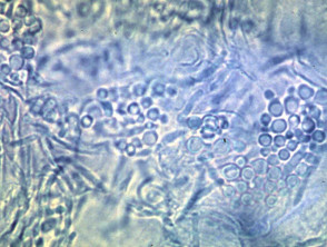 Microscopy of malassezia