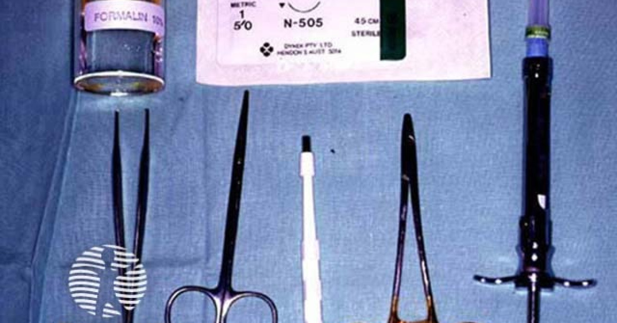 Punch biopsy tray image