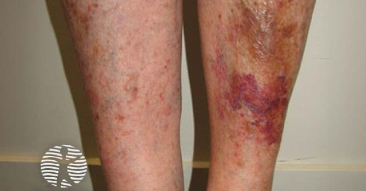 case2 image