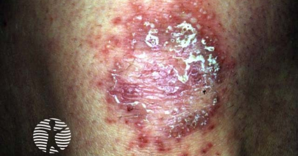 case9 image