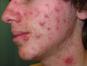 itchy rash on face
