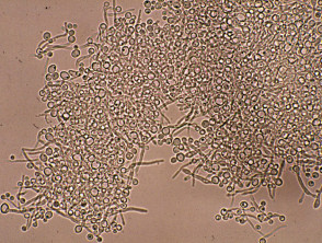 fungus on feet microscopic