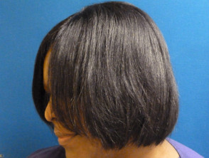 Relaxer used to striaghten hair in woman of African descent