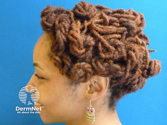 Locks in woman of African descent