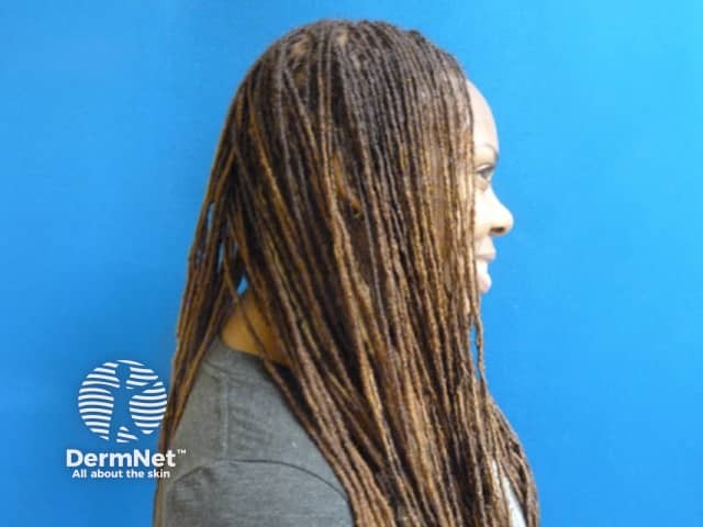Locks in woman of African descent