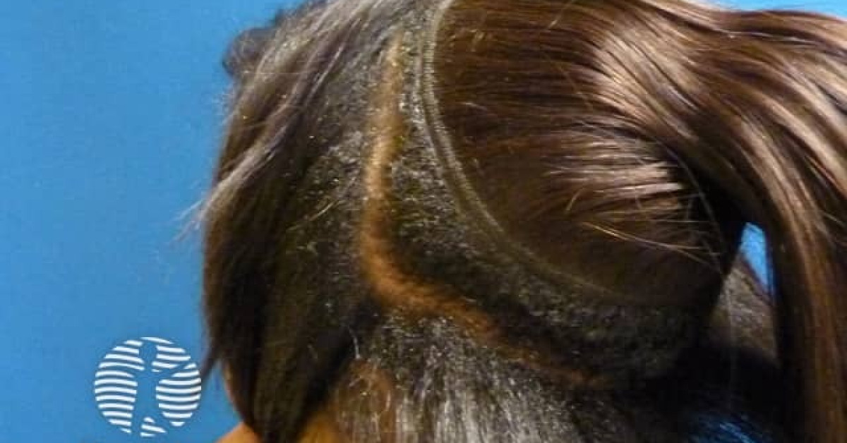 Natural hair with weaves in woman of African descent image