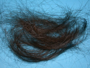 Anagen effluvium: hair pull