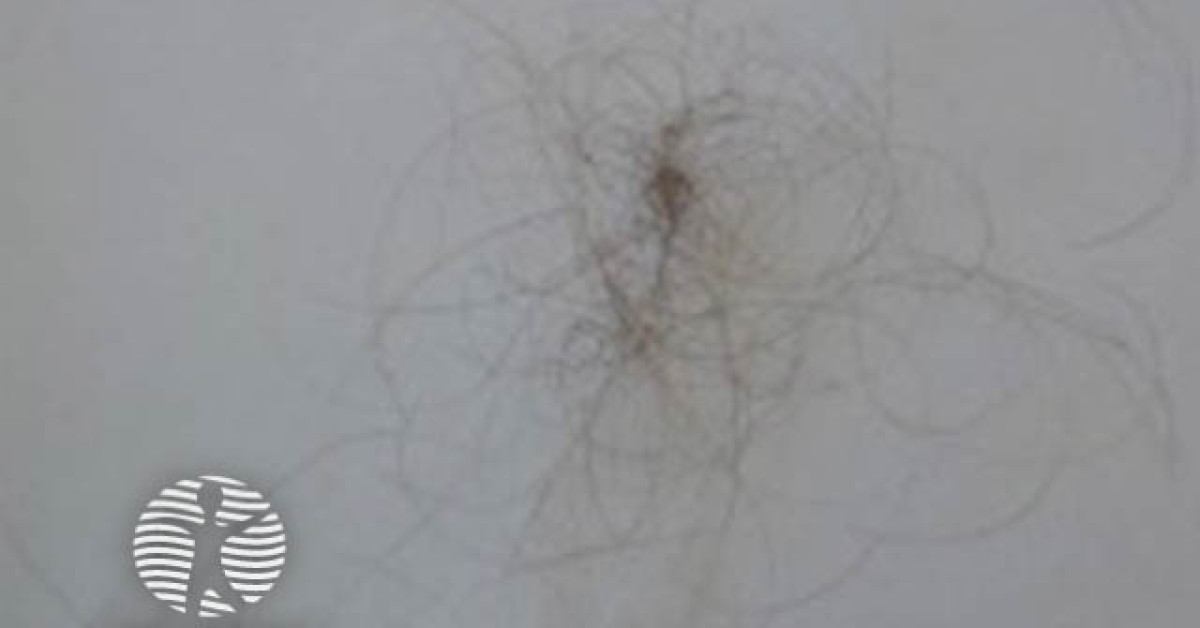 hair shedding 03 image