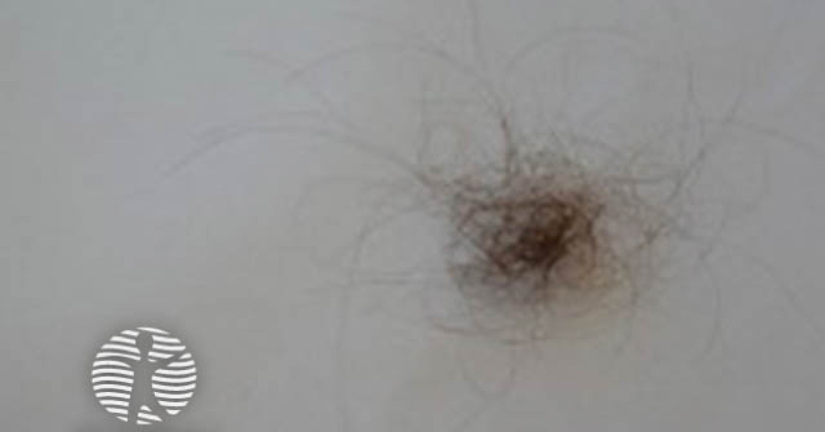 hair shedding 04 image