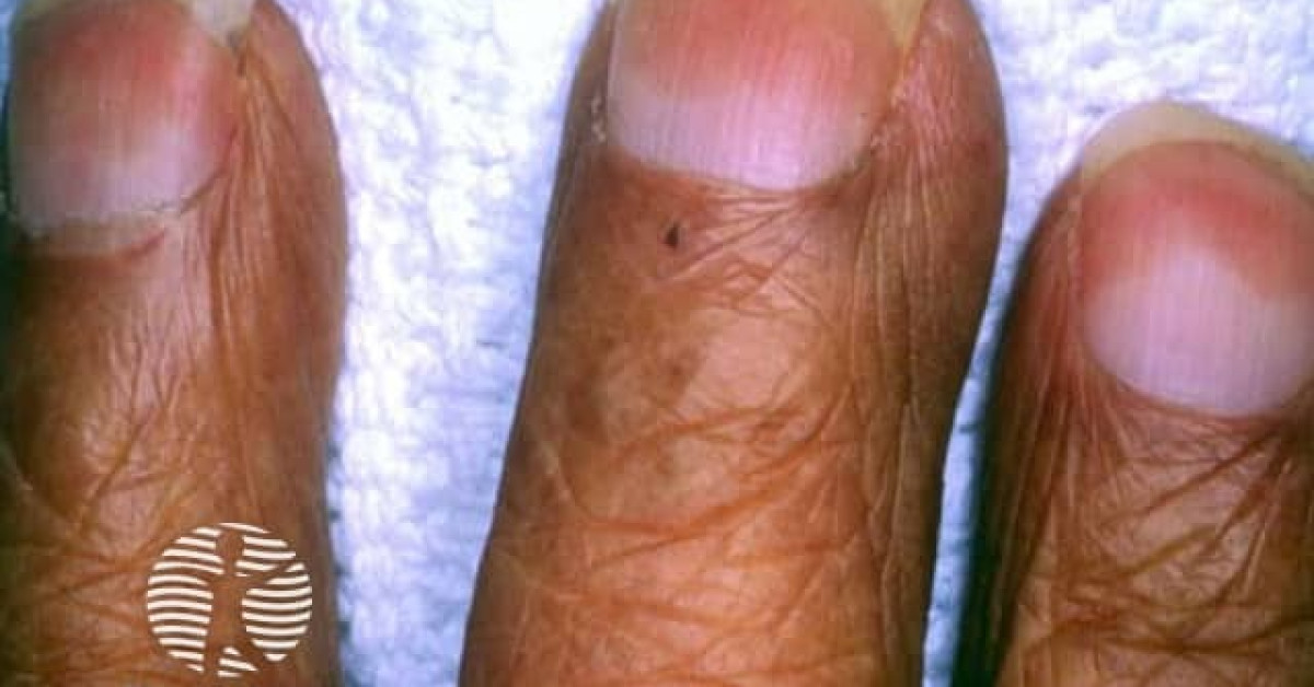 Half and half nail image