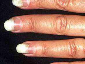 Knocked Up Nails - Pregnancy safe nail polish – Baby Blossom Australia