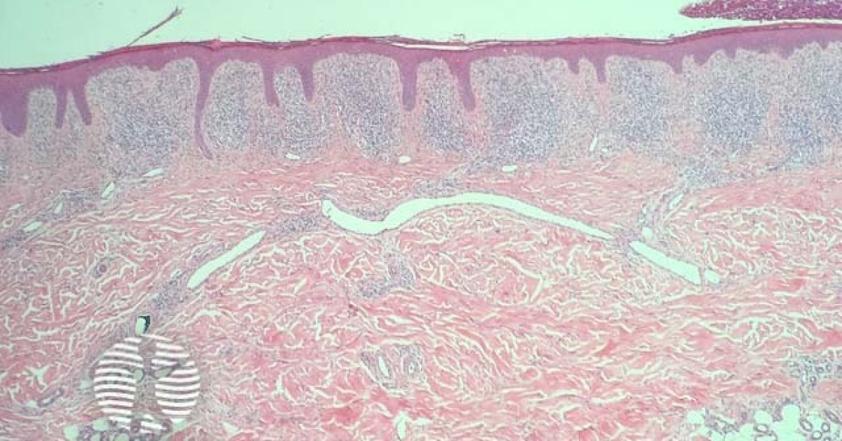 Lichen aureus image