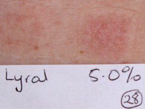 Positive patch test to lyral