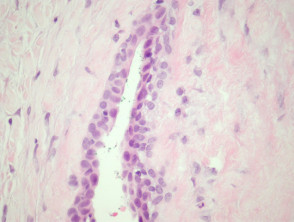 Median raphe cyst pathology