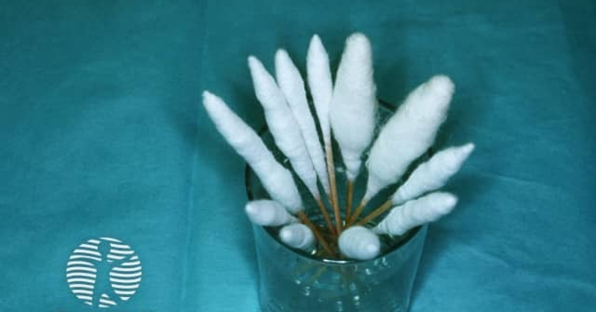 Large cotton swabs used for cryotherapy image