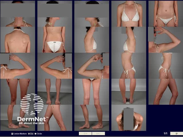 Whole body images