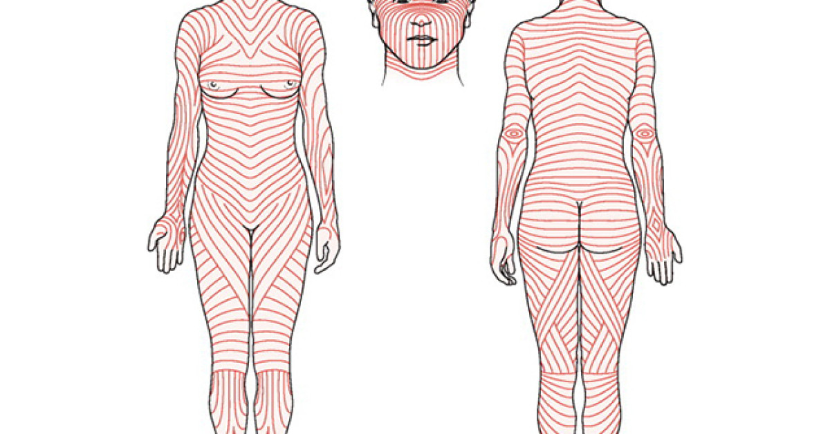 Skin tension lines image