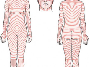 Skin tension lines | DermNet NZ