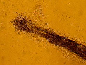 Ectothrix invasion by fungal hyphae in a hair shaft