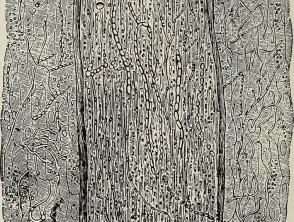 Endothrix invasion of a hair shaft by Trichophyton tonsurans 