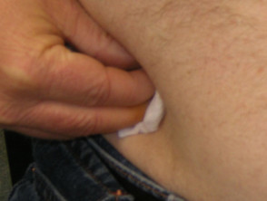 Pressing on subcutaneous injection site