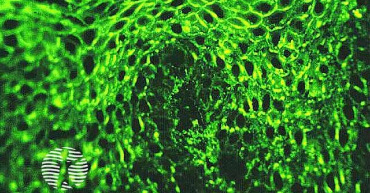 Pemphigus vulgaris image