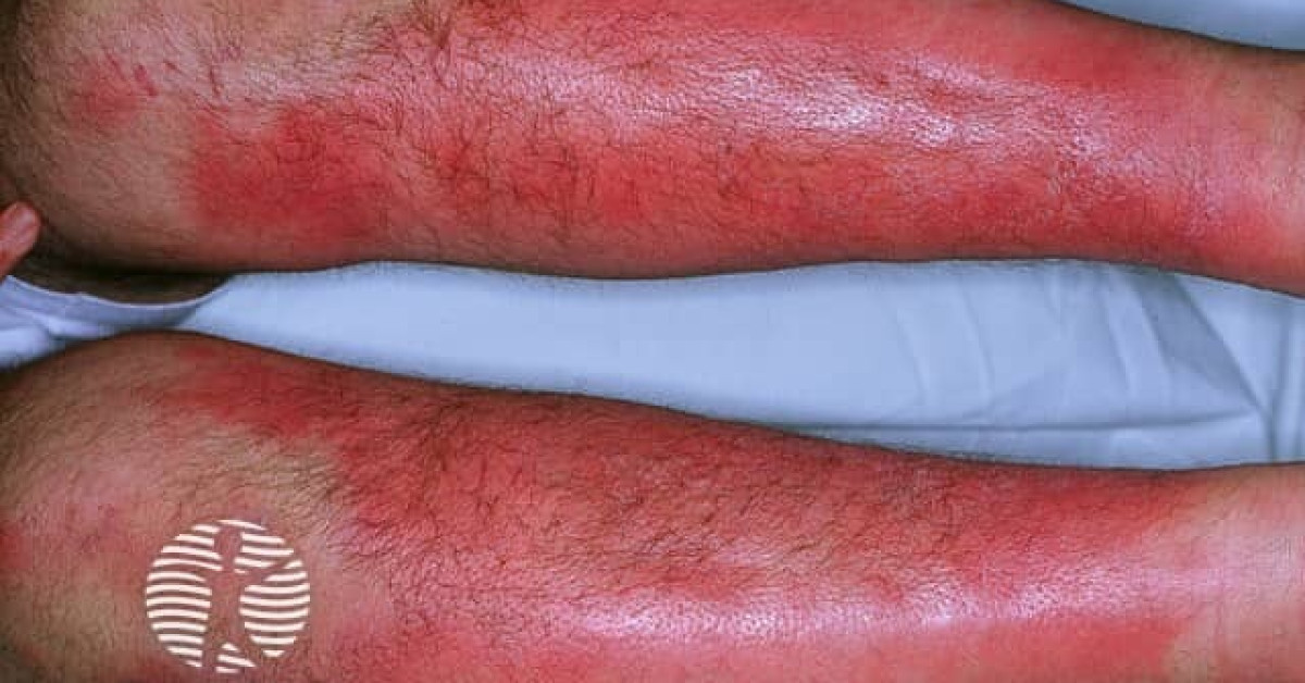 en11.jpg image
